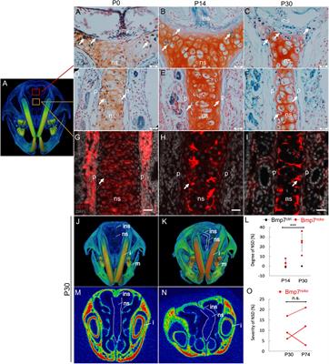 Nasal Septum Deviation as the Consequence of BMP-Controlled Changes to Cartilage Properties